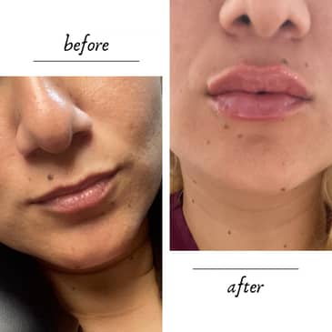 Slider image (8) ICONIC Medical Aesthetic